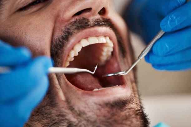 Best Emergency Dental Services for Seniors in Huntington, WV