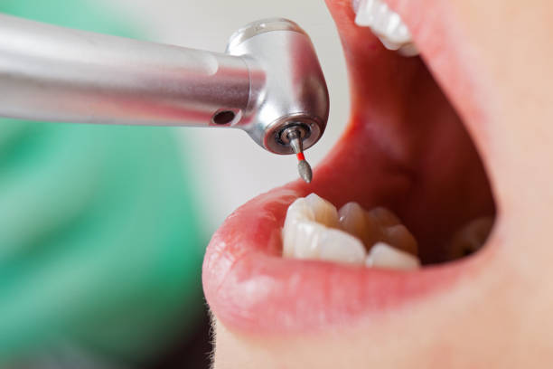 Best Mobile Emergency Dentist in Huntington, WV
